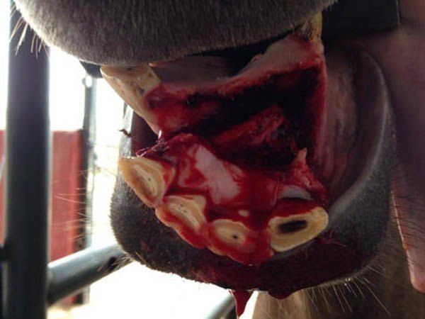 FRACTURA MANDIBULAR